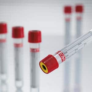 VACUETTE¨ Tube, Serum/Sep, 5ml, 13x100mm, Red/Yellow, Sterile - Pack Of 50