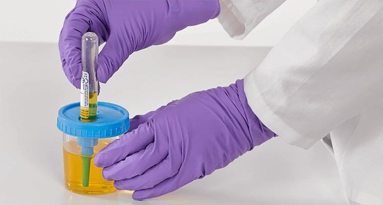 BD Vacutainer Sterile Specimen Collection Cup 120ml - Pack of 200 ...