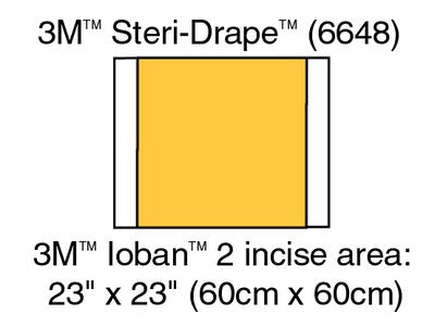 Ioban Antimicrobial Drape